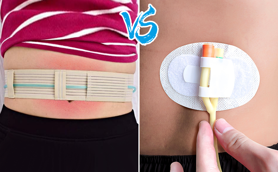 Catheter tube holder